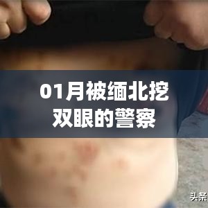 緬北警察遭遇暴力襲擊，雙眼被挖事件回顧