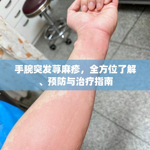 手腕突發(fā)蕁麻疹，全方位了解、預(yù)防與治療指南