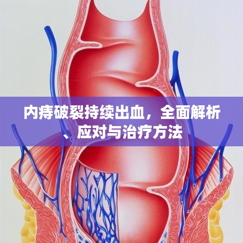 內(nèi)痔破裂持續(xù)出血，全面解析、應(yīng)對(duì)與治療方法