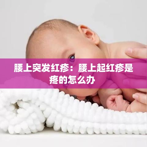 腰上突發(fā)紅疹：腰上起紅疹是疼的怎么辦 