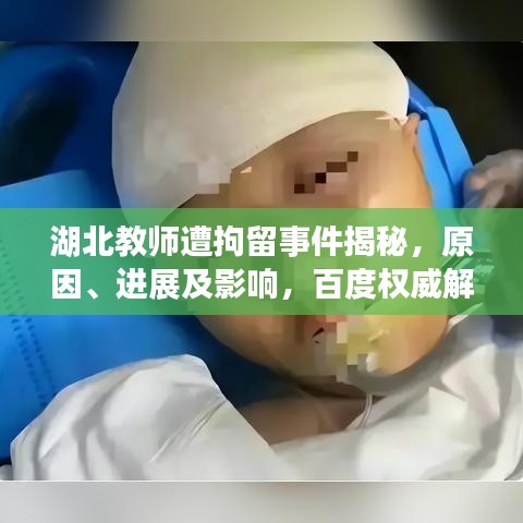 湖北教師遭拘留事件揭秘，原因、進展及影響，百度權威解讀！