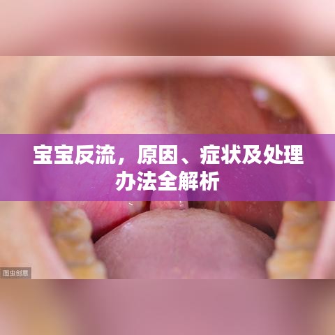 寶寶反流，原因、癥狀及處理辦法全解析