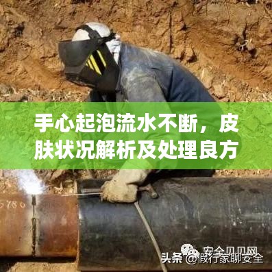 手心起泡流水不斷，皮膚狀況解析及處理良方