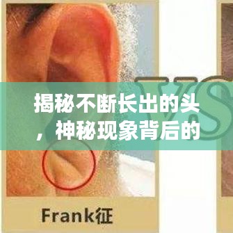 揭秘不斷長出的頭，神秘現(xiàn)象背后的醫(yī)學(xué)探索之旅