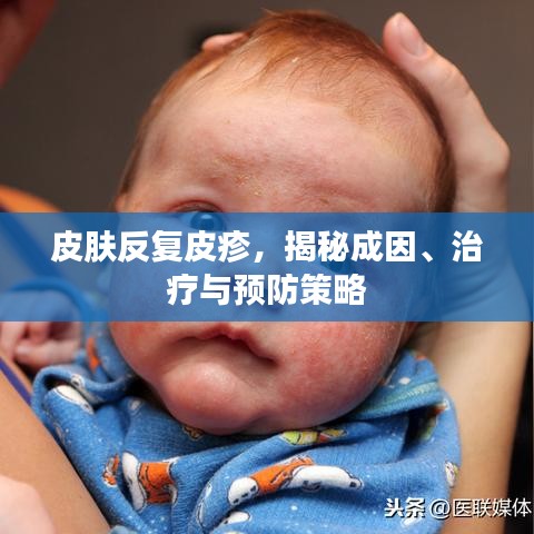 皮膚反復(fù)皮疹，揭秘成因、治療與預(yù)防策略