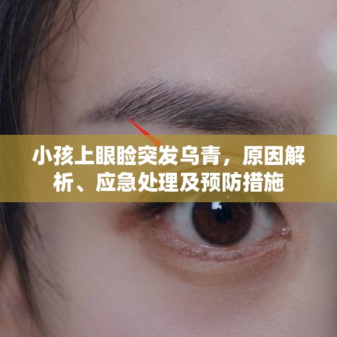 小孩上眼瞼突發(fā)烏青，原因解析、應(yīng)急處理及預(yù)防措施