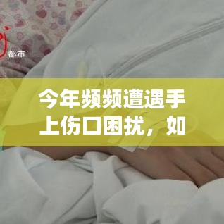 今年頻頻遭遇手上傷口困擾，如何應(yīng)對挑戰(zhàn)？
