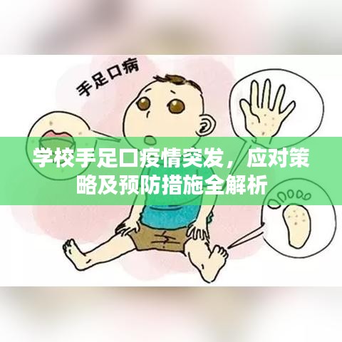 學校手足口疫情突發(fā)，應對策略及預防措施全解析